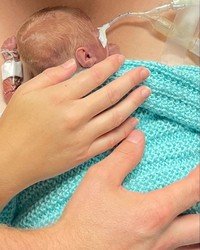Premature baby wrapped in blue blanket, receiving care.